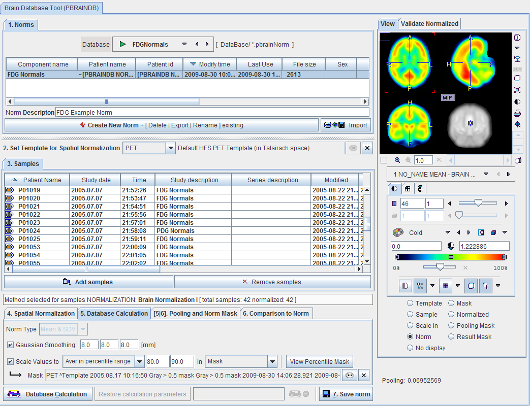 Brain DB Editor User Interface