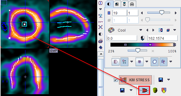 PCARD Polar Sampling 2D